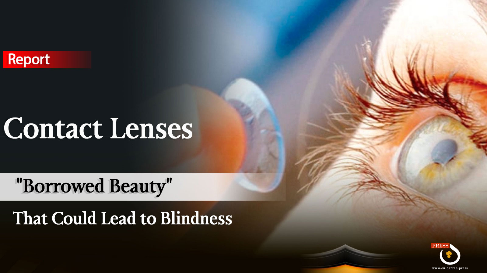 Contact Lenses: "Borrowed Beauty" That Could Lead to Blindness