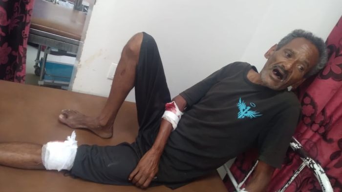 Three Civilians Injured by Houthi Shelling in Taiz