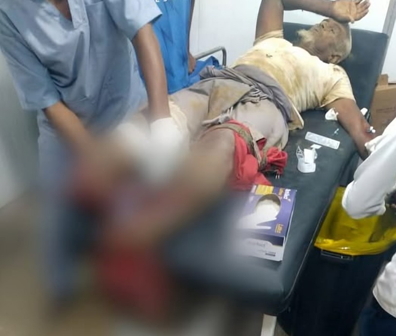 Elderly Man Loses Legs to Houthi Landmine Explosion in Hajjah