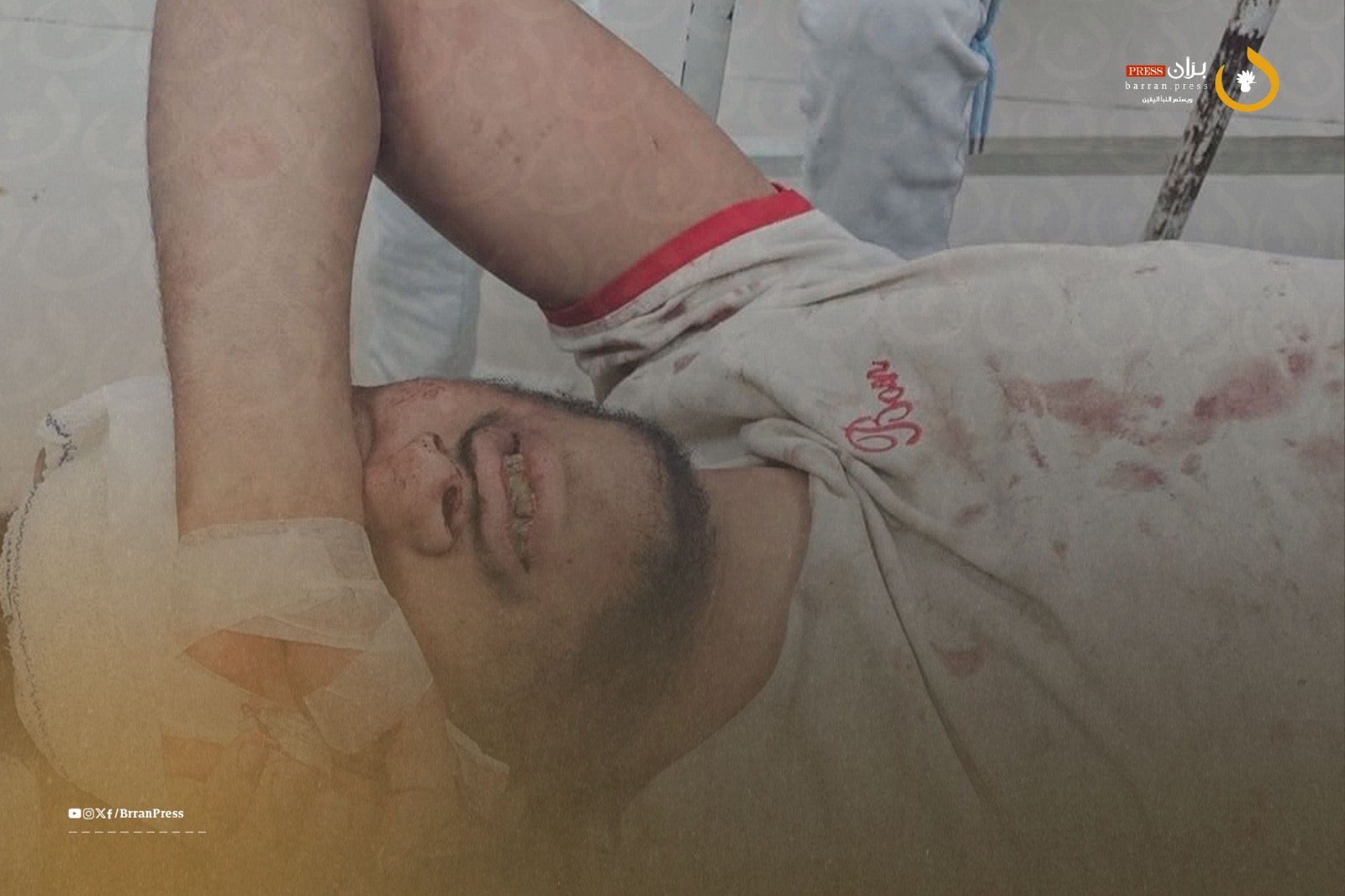 Houthi Sniper Injures Young Man in Taiz, Marking Fifth Attack in Weeks