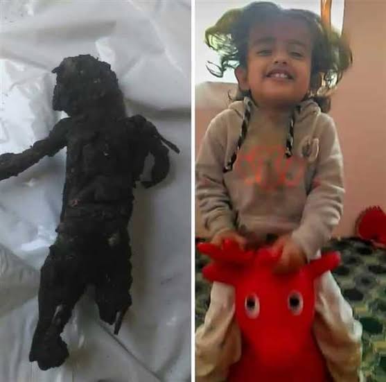 Child Layan who was killed in the Houthi missile attack Child Layan who was killed in the Houthi missile attack