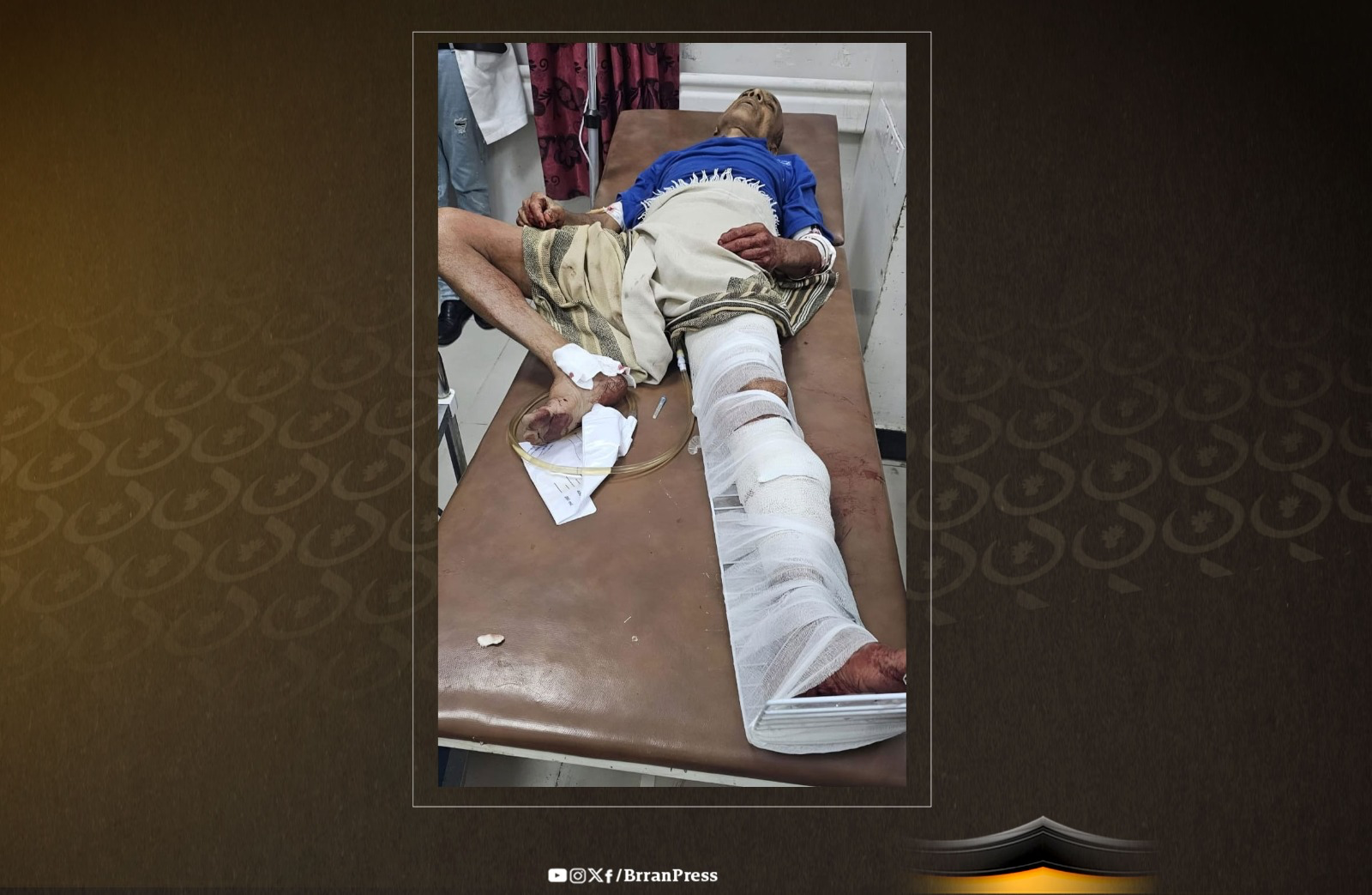 Elderly Man Shot in Third Houthi Sniper Attack in Taiz